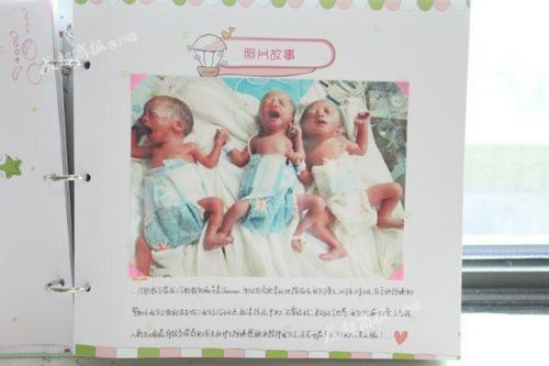 成都女子诞下单卵三胞胎