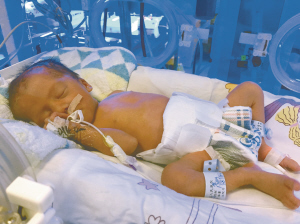 成都女子诞下单卵三胞胎